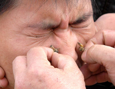 guy getting stung on the face by bees apitherapy